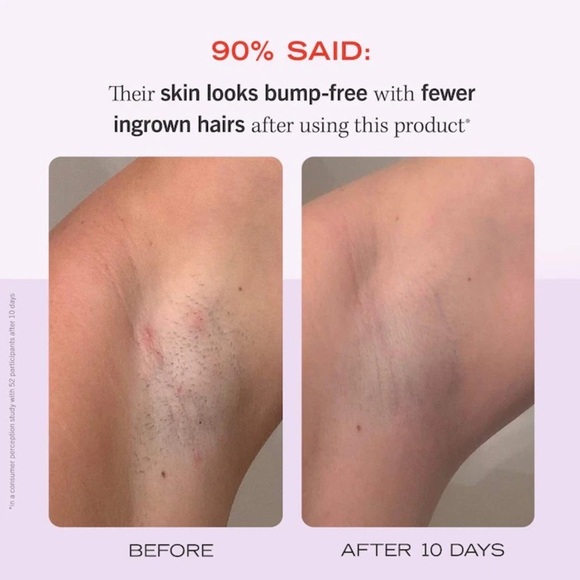 First Aid Beauty Ingrown Hair Pads with BHA & AHA - Picture 3 of 5